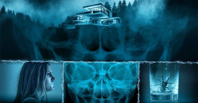 قفل آرواره - پس‌زمینه