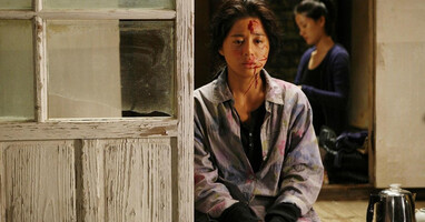  تصویر گیج شده